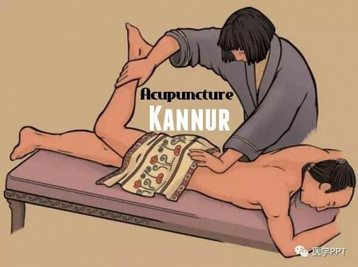 CHINESE NEURO - SPINAL ACUPUNCTURE METHOD (CN-SRT): Modern scientific approach in the treatment of disorders related with SPINE, NERVES and JOINTS invented and developed by Prof.C.UNNIKRISHNAN